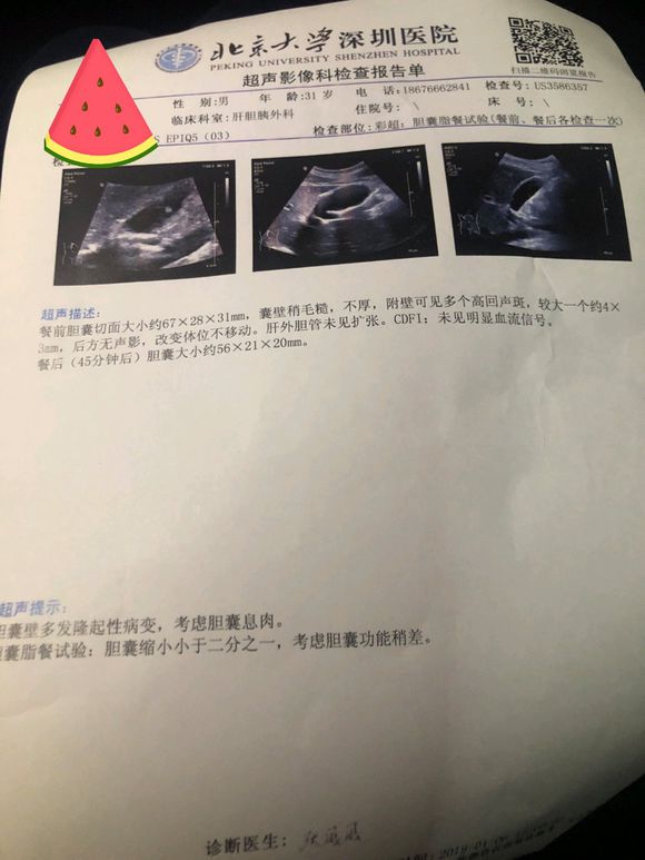 吧友们，帮忙看看，右上腹疼痛3个月了，拉肚子！