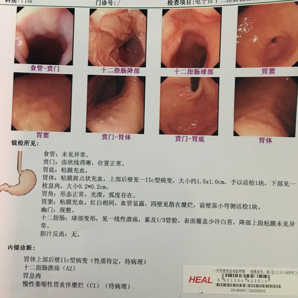 为什么这样的事情又一次发生在我身上