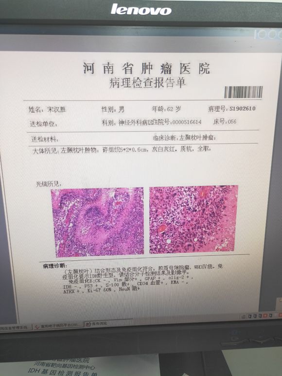 我爸爸62岁，现在是脑肿瘤母细胞4级