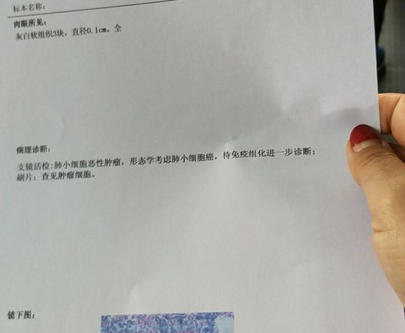 这是肺癌晚期么