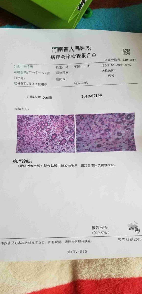 最近刚检查出来的，觉得接受不了。