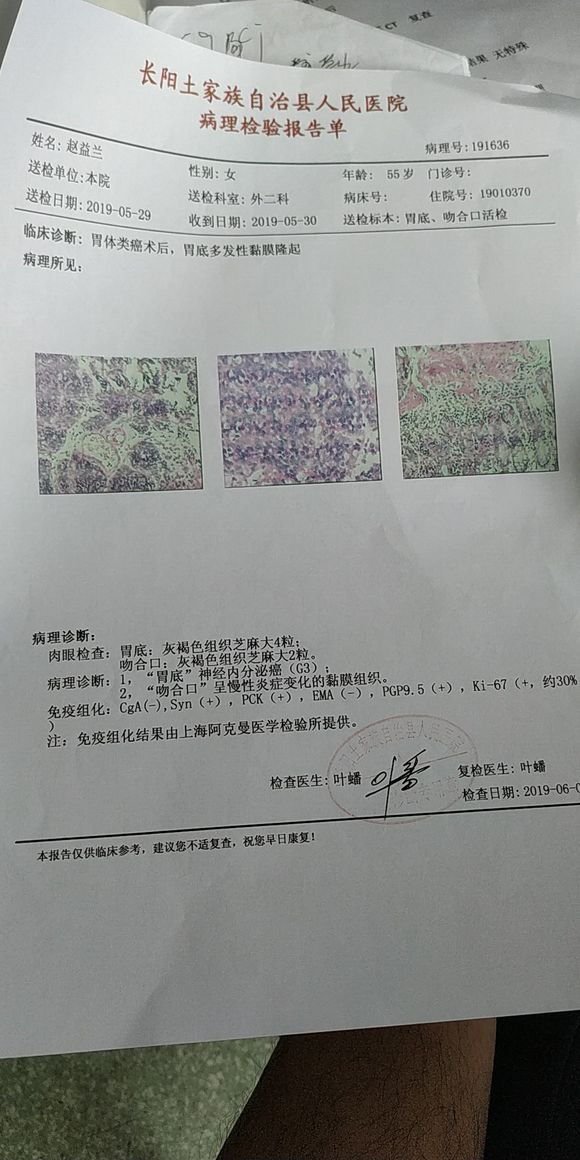 我妈妈去年做的胃切除手术，切了4分之三的胃