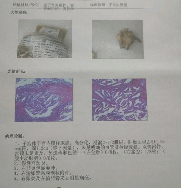 母亲得了子宫内膜癌，天塌了。