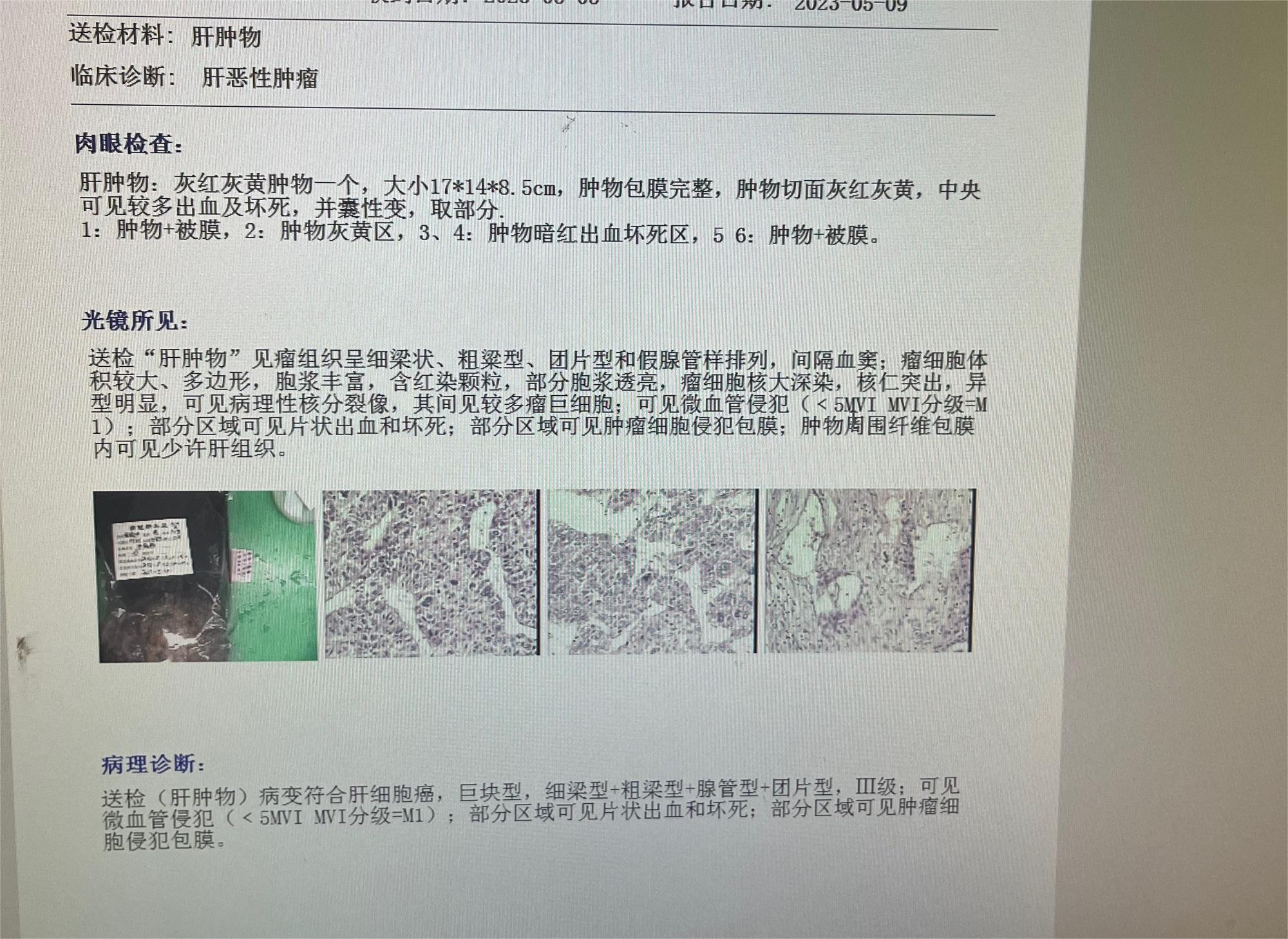 术后10天恢复正常