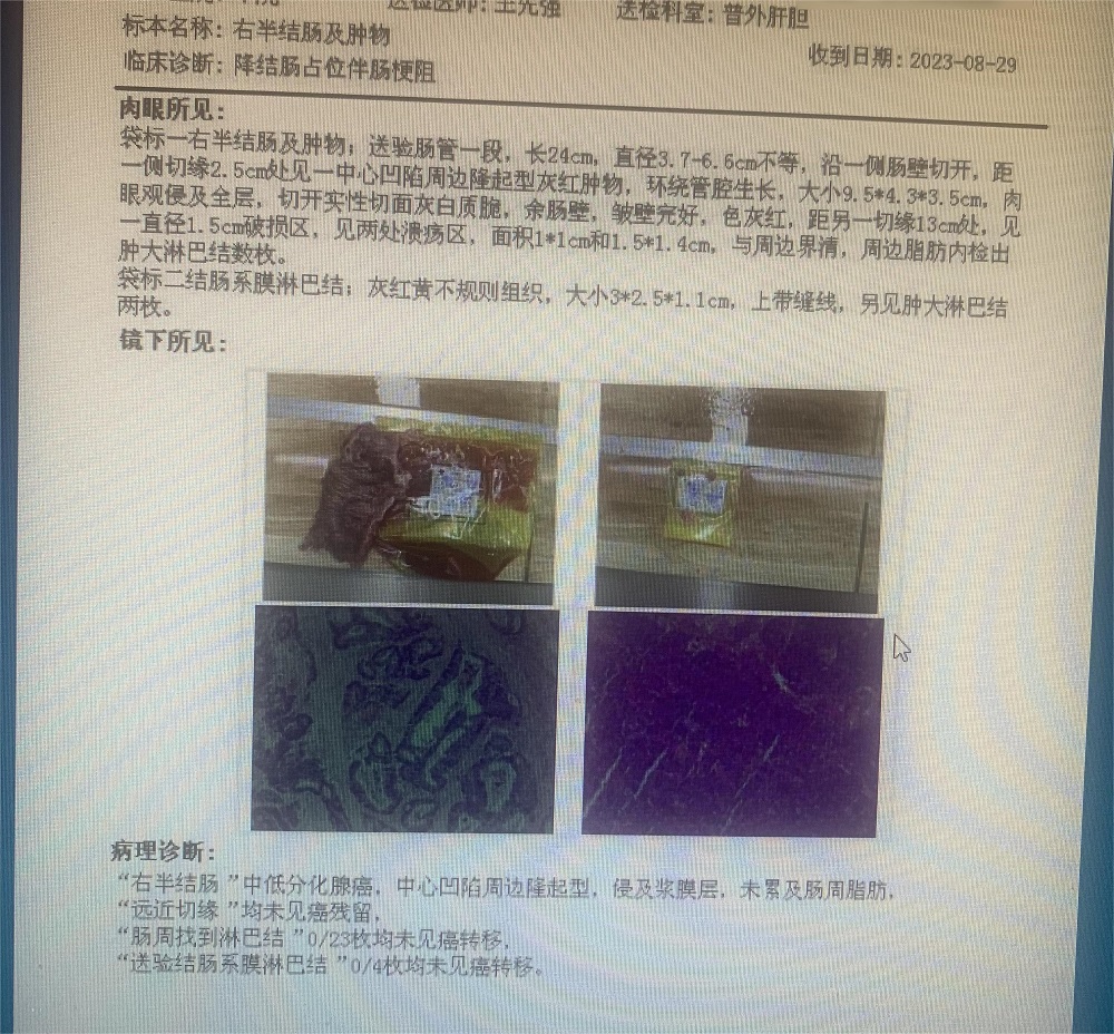 有没有大神分析一下，我父亲这个严重吗，急！！